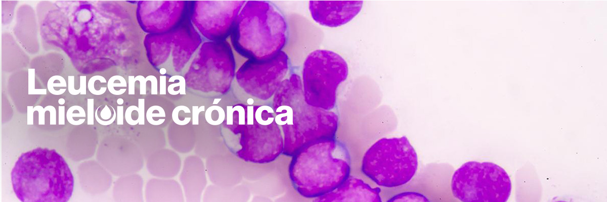 leucemia mieloide crónica