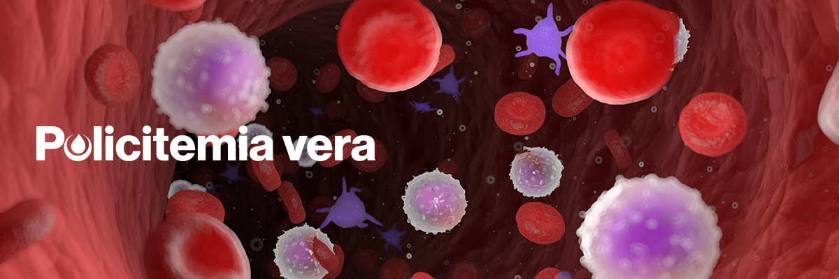 policitemia vera