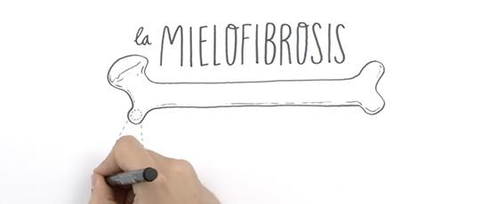 vídeos para  conocer la mielofibrosis